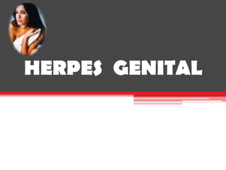 HERPES GENITAL

 