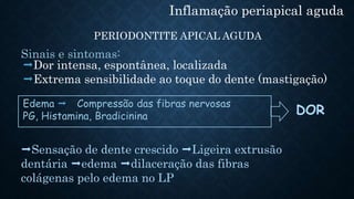 Inflamação periapical aguda
PERIODONTITE APICAL AGUDA
Dor intensa, espontânea, localizada
Extrema sensibilidade ao toque do dente (mastigação)
Sinais e sintomas:
Sensação de dente crescido Ligeira extrusão
dentária edema dilaceração das fibras
colágenas pelo edema no LP
Edema  Compressão das fibras nervosas
PG, Histamina, Bradicinina DOR
 