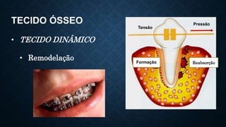 TECIDO ÓSSEO
• TECIDO DINÂMICO
• Remodelação
Tensão
Pressão
Formação Reabsorção
 