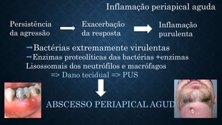 Inflamação periapical aguda
Persistência
da agressão
Bactérias extremamente virulentas
Enzimas proteolíticas das bactérias +enzimas
Lisossomais dos neutrófilos e macrófagos
=> Dano tecidual => PUS
ABSCESSO PERIAPICAL AGUDO
Exacerbação
da resposta
Inflamação
purulenta
 