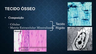 TECIDO ÓSSEO
• Composição
- Células
- Matriz Extracelular Mineralizada
Tecido
Rígido
 