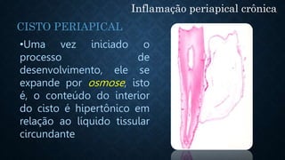 •Uma vez iniciado o
processo de
desenvolvimento, ele se
expande por osmose, isto
é, o conteúdo do interior
do cisto é hipertônico em
relação ao líquido tissular
circundante
Inflamação periapical crônica
CISTO PERIAPICAL
 