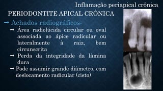 Inflamação periapical crônica
PERIODONTITE APICAL CRÔNICA
 Achados radiográficos:
 Área radiolúcida circular ou oval
associada ao ápice radicular ou
lateralmente à raiz, bem
circunscrita
 Perda da integridade da lâmina
dura
 Pode assumir grande diâmetro, com
deslocamento radicular (cisto)
 