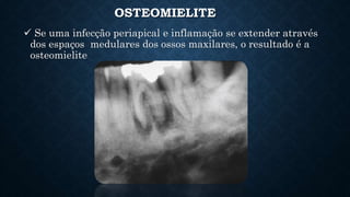 OSTEOMIELITE
 Se uma infecção periapical e inflamação se extender através
dos espaços medulares dos ossos maxilares, o resultado é a
osteomielite
 