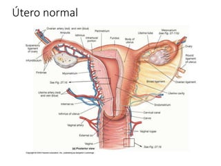 Útero normal
 