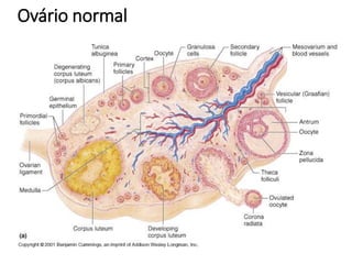 Ovário normal
 