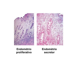 Endométrio
proliferativo
Endométrio
secretor
 