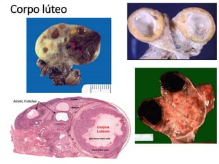Corpo lúteo
 