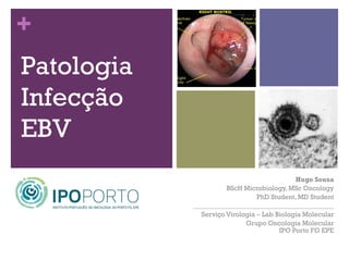 +
Patologia
Infecção
EBV
                                            Hugo Sousa
                      BScH Microbiology, MSc Oncology
                                PhD Student, MD Student
            _________________________________________
              Serviço Virologia – Lab Biologia Molecular
                            Grupo Oncologia Molecular
                                       IPO Porto FG EPE
 