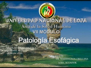 UNIVERSIDAD NACIONAL DE LOJA
Área de la Salud Humana
VII MÓDULO

 EDGAR CHUQUIHUANCA
 DANIEL RUIZ
 FREDY VERA
 DOCENTE:
DR. WASHINGTON ORELLANA
LOJA , ECUADOR.

 