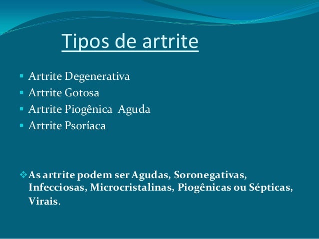 Exames para detectar artrite reumatoide