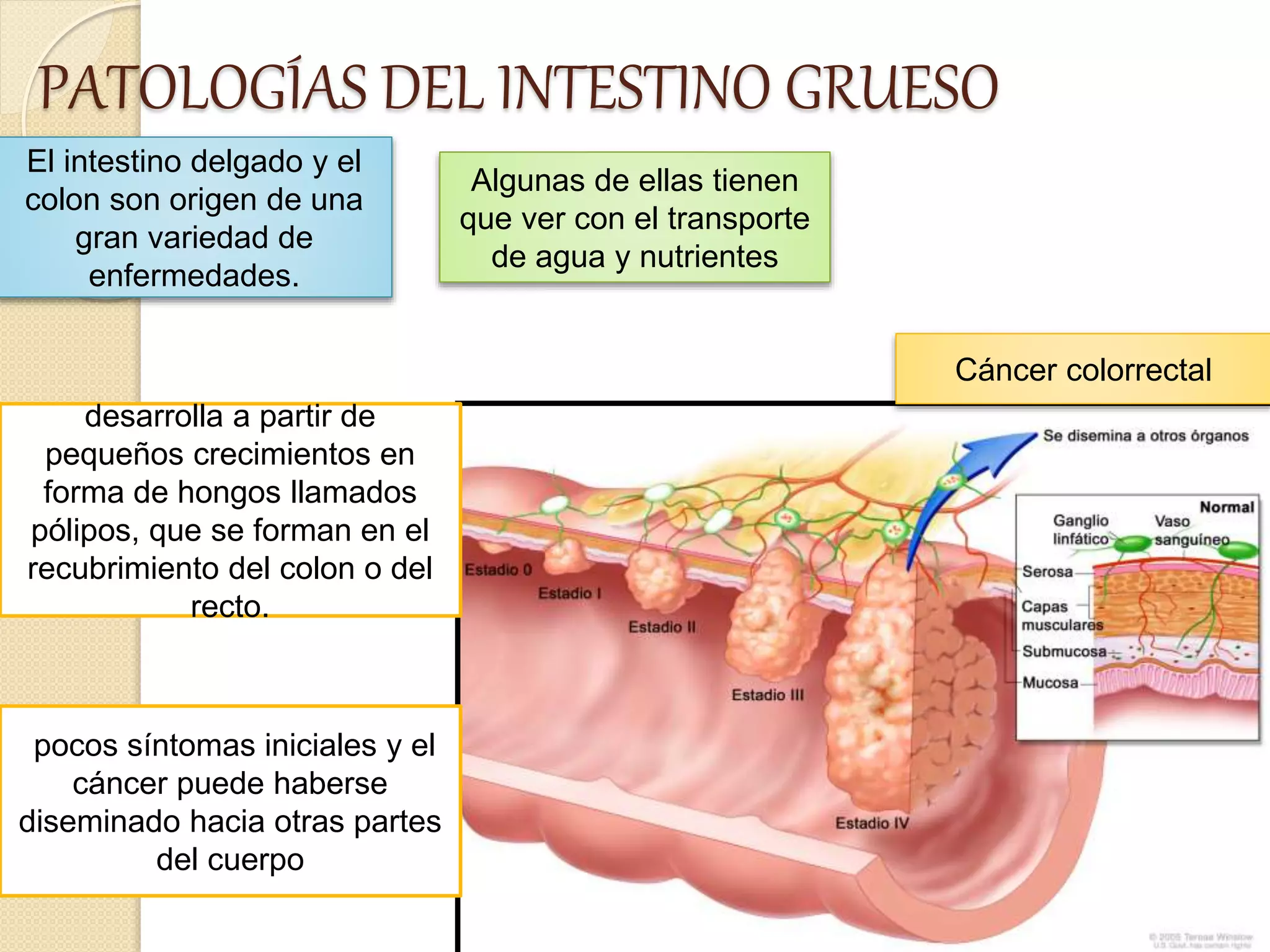 Intestino Normal Patologias del intestino grueso | PPTX