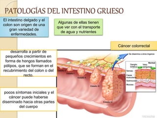 PATOLOGÍAS DEL INTESTINO GRUESO
El intestino delgado y el
colon son origen de una
gran variedad de
enfermedades.
Algunas de ellas tienen
que ver con el transporte
de agua y nutrientes
Cáncer colorrectal
desarrolla a partir de
pequeños crecimientos en
forma de hongos llamados
pólipos, que se forman en el
recubrimiento del colon o del
recto.
pocos síntomas iniciales y el
cáncer puede haberse
diseminado hacia otras partes
del cuerpo
 