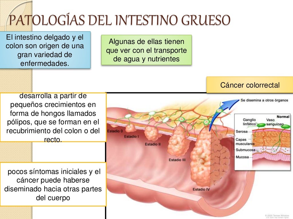 Patologias del intestino grueso
