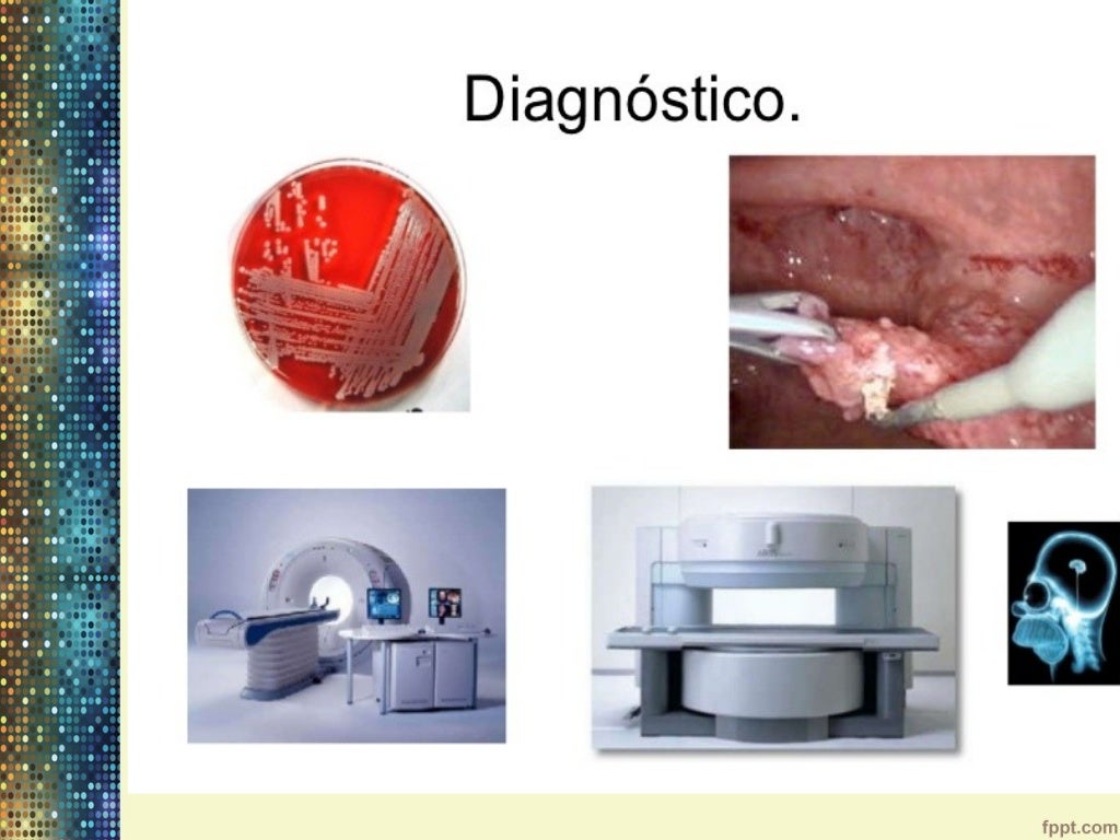 gangrena de fournier