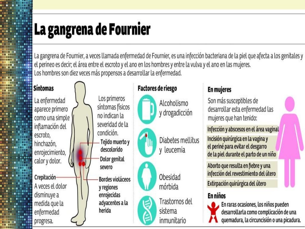 gangrena de fournier gangrena de fournier