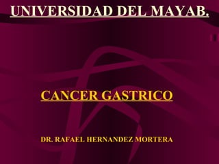 CANCER GASTRICO DR. RAFAEL HERNANDEZ MORTERA ,[object Object]