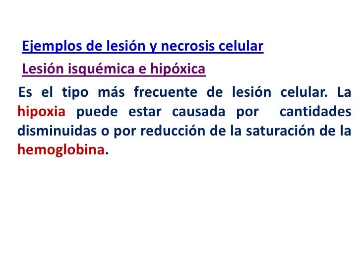 El estiramiento de la columna vertebral a sheynom la osteocondrosis