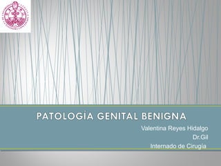 Valentina Reyes Hidalgo
Dr.Gil
Internado de Cirugía
 