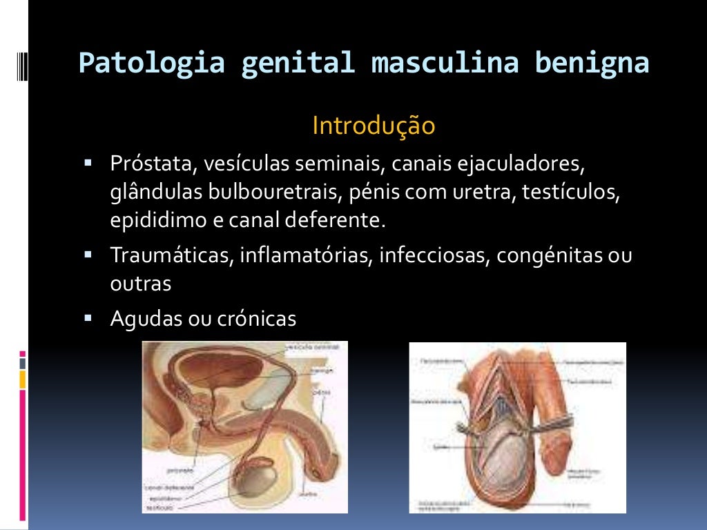 Patologia genital masculina benigna