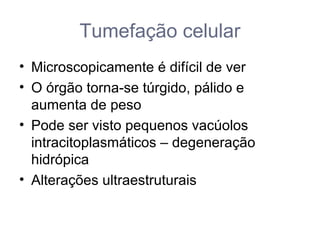 Tumefação celular
• Microscopicamente é difícil de ver
• O órgão torna-se túrgido, pálido e
aumenta de peso
• Pode ser visto pequenos vacúolos
intracitoplasmáticos – degeneração
hidrópica
• Alterações ultraestruturais
 