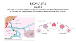 NEOPLASIAS
CÂNCER
Termo usado para descrever as formas mais agressivas de neoplasias, caracterizado pela proliferação celular
descontrolada, que leva a formação de tumores malignos capaz de disseminar-se por metástase.
 