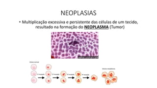NEOPLASIAS
• Multiplicação excessiva e persistente das células de um tecido,
resultado na formação do NEOPLASMA (Tumor)
 