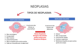 NEOPLASIAS
NEOPLASMA BENIGNO
NEOPLASMA MALIGNO
 Não cancerígeno
 Encapsulado
 Não invasivo
 Crescimento lento
 Não se espalha para outras partes
 Pode ser removido por cirurgia local
 Câncer
 Não encapsulado
 Crescimento rápido
 Invasivo e agressivo
 Metástase (espalha-se para outras
partes do corpo)
TIPOS DE NEOPLASMA
A estrutura das
Células se
assemelham
A estrutura das
Células são
diferentes
Muitas Neoplasias
Benignas não tratadas
podem evoluir para
Neoplasias Malignas
 