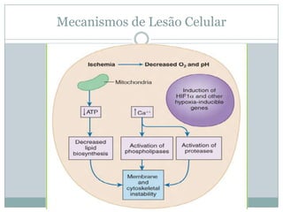 Mecanismos de Lesão Celular
 