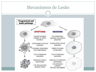 Mecanismos de Lesão
 