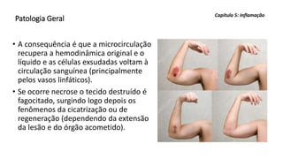 Patologia Geral
• A consequência é que a microcirculação
recupera a hemodinâmica original e o
líquido e as células exsudadas voltam à
circulação sanguínea (principalmente
pelos vasos linfáticos).
• Se ocorre necrose o tecido destruído é
fagocitado, surgindo logo depois os
fenômenos da cicatrização ou de
regeneração (dependendo da extensão
da lesão e do órgão acometido).
Capítulo 5: Inflamação
 
