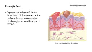 Patologia Geral
• O processo inflamatório é um
fenômeno dinâmico e essa é a
razão pela qual seu aspecto
morfológico se modifica com o
tempo.
Capítulo 5: Inflamação
Processo de cicatrização tecidual
 