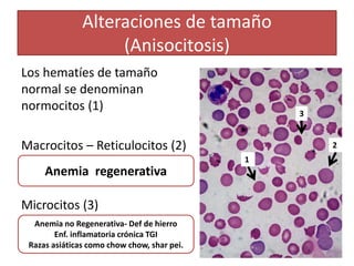Alteraciones de tamaño
(Anisocitosis)
Los hematíes de tamaño
normal se denominan
normocitos (1)
Macrocitos – Reticulocitos (2)
Microcitos (3)
1
2
3
Anemia no Regenerativa- Def de hierro
Enf. inflamatoria crónica TGI
Razas asiáticas como chow chow, shar pei.
Anemia regenerativa
 