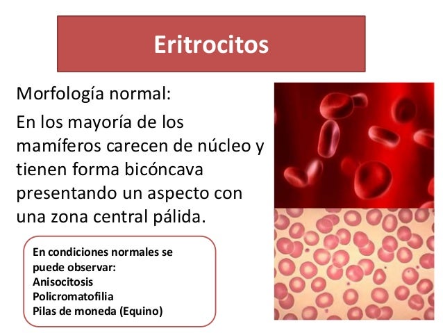 Patología hemolinfatico