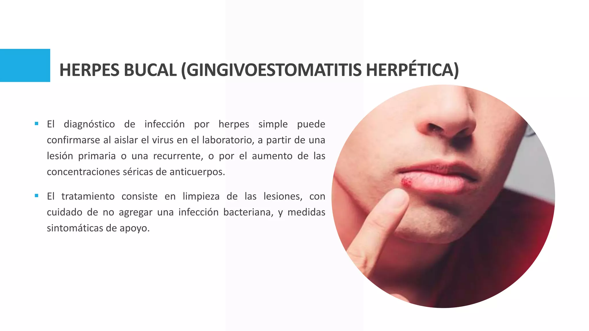 Patología inflamatoria e infecciosa de cavidad oral.pptx