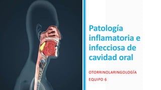 Patología
inflamatoria e
infecciosa de
cavidad oral
OTORRINOLARINGOLOGÍA
EQUIPO 6
 