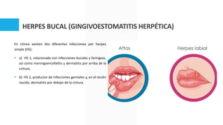 HERPES BUCAL (GINGIVOESTOMATITIS HERPÉTICA)
En clínica existen dos diferentes infecciones por herpes
simple (HS):
 a) HS ...