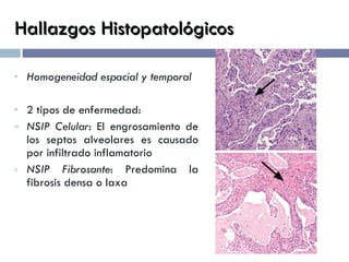 Hallazgos Histopatológicos Homogeneidad espacial y temporal 2 tipos de enfermedad: NSIP Celular : El engrosamiento de los septos alveolares es causado por infiltrado inflamatorio NSIP Fibrosante : Predomina la fibrosis densa o laxa 