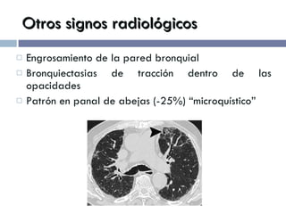 Otros signos radiológicos Engrosamiento de la pared bronquial Bronquiectasias de tracción dentro de las opacidades Patrón en panal de abejas (-25%) “microquístico” 