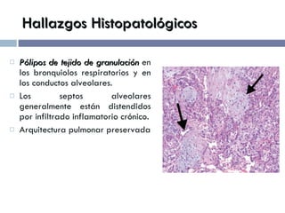 Hallazgos Histopatológicos Pólipos de tejido de granulación   en los bronquiolos respiratorios y en los conductos alveolares.  Los septos alveolares generalmente están distendidos por infiltrado inflamatorio crónico. Arquitectura pulmonar preservada 