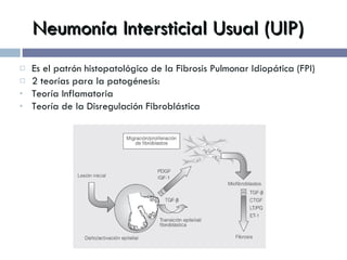 Neumonía Intersticial Usual (UIP) Es el patrón histopatológico de la Fibrosis Pulmonar Idiopática (FPI) 2 teorías para la patogénesis: Teoría Inflamatoria Teoría de la Disregulación Fibroblástica 
