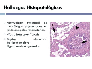 Hallazgos Histopatológicos Acumulación multifocal de macrófagos pigmentados en los bronquiolos respiratorios. Vías aéres: Leve fibrosis  Septos alveolares peribronquiolares: Ligeramente engrosados 