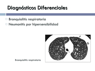 Diagnósticos Diferenciales Bronquiolitis respiratoria Neumonitis por hipersensibilidad Bronquiolitis respiratoria 