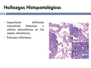 Hallazgos Histopatológicos Importante infiltrado intersticial: linfocitos y células plasmáticas en los septos alveolares. Folículos linfoideos 