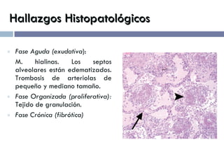 Hallazgos Histopatológicos Fase Aguda (exudativa ):  M. hialinas. Los septos alveolares están edematizados. Trombosis de arteriolas de pequeño y mediano tamaño. Fase Organizada (proliferativa):  Tejido de granulación. Fase Crónica (fibrótica) 