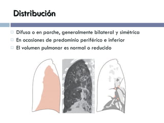 Distribución Difusa o en parche, generalmente bilateral y simétrica En ocasiones de predominio periférico e inferior El volumen pulmonar es normal o reducido 