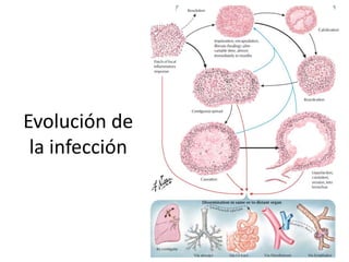 Evolución de
la infección
 