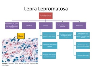 Lepra Lepromatosa
Características
No hay buena rta. Celular,
no se forma granuloma,
alta concentración de
bacilos.
CONTAGIA Lesiones
Lesiones que evolucionan:
Mácula →Pápula→Ulcera
Destrucción de los anexos
de la piel
Afectación de los nervios
periféricos: anestesia
Prueba de Lepromina:
Negativa
El huésped no tiene una
rta. Inmune celular
adecuada
Afectaciones
Piel de la cara: Las
nodulaciones pueden
confluir y formar la facies
leonina
Cavidad nasal con
destrucción del tabique
Testículos: esterilidad
Globi
 