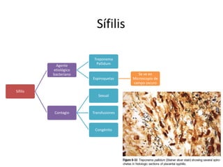 Sífilis
Sífilis
Agente
etiológico
bacteriano
Treponema
Pallidum
Espiroquetas
Se ve en
Microscopio de
campo oscuro
Contagio
Sexual
Transfusiones
Congénito
 