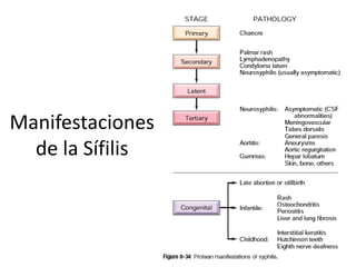 Manifestaciones
de la Sífilis
 